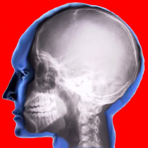 Craniossacral